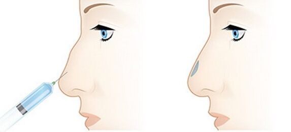 The procedure allows you to adjust various problems