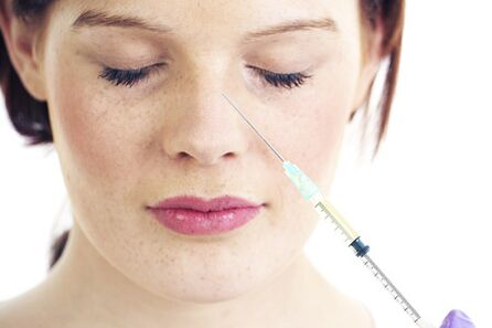 Non-surgical rhinoplasty with filling